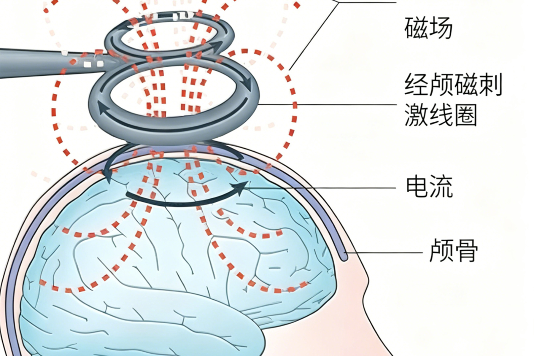 孩子上课老是走神、坐不住,是病吗?给大脑“充电”后,“老实”多了